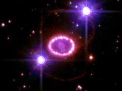 SN 1987Aβ